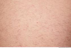 Photo Textures of Human Skin